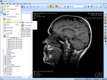 Philips dicom viewer free download